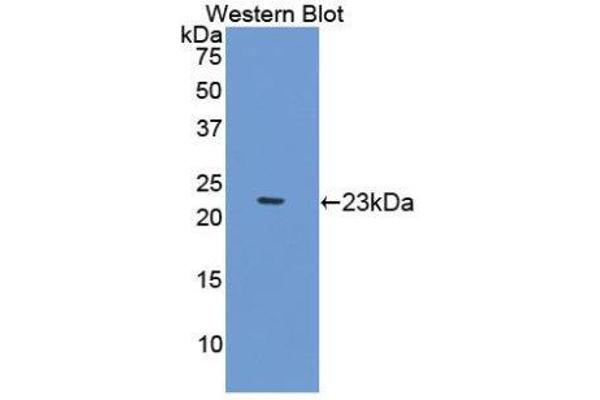 Gastrokine 2 Antikörper  (AA 21-184)