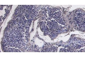 (ABIN7505817) Negative Control showing staining of paraffin embedded Human Testis, with no primary antibody. (ACE2 Antikörper  (C-Term))