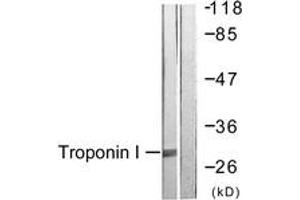 Western blot analysis of extracts from Jurkat cells, using TNNI3 (Ab-43) Antibody. (TNNI3 Antikörper  (AA 11-60))