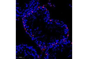 Immunofluorescence of paraffin embedded rat testis using kb12 (ABIN7075406) at dilution of 1:700 (260x lens) (p130 Antikörper)