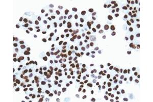 Immunohistochemical staining of SV40 large T, small t antigen. (SV40 Large T and Small Ts Antikörper)