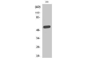 Western Blotting (WB) image for anti-Telomeric Repeat Binding Factor 2, Interacting Protein (TERF2IP) (Internal Region) antibody (ABIN3177145) (RAP1 Antikörper  (Internal Region))