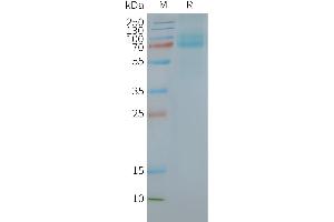 Human -Nanodisc, Flag Tag on SDS-PAGE (FZD10 Protein)