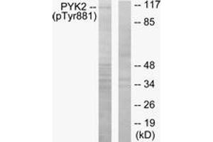 Western blot analysis of extracts from mouse brain, using PYK2 (Phospho-Tyr881) Antibody. (PTK2B Antikörper  (pTyr881))