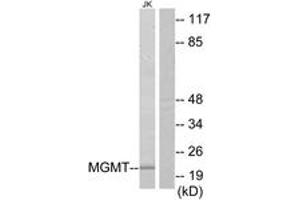 Western Blotting (WB) image for anti-O6-Methylguanine-DNA-Methyltransferase (MGMT) (AA 1-50) antibody (ABIN2890010) (MGMT Antikörper  (AA 1-50))