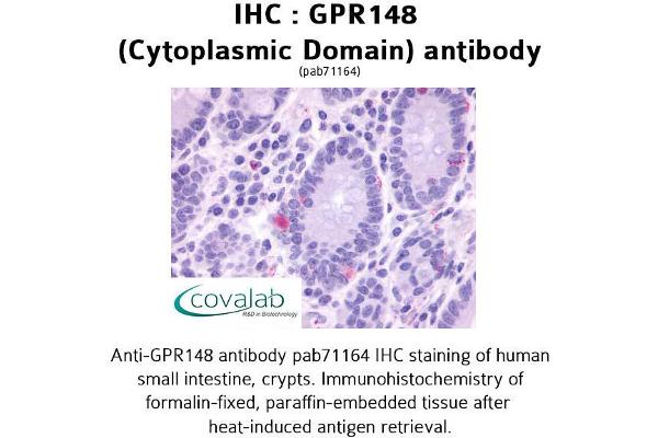 GPR148 Antikörper  (3rd Cytoplasmic Domain)