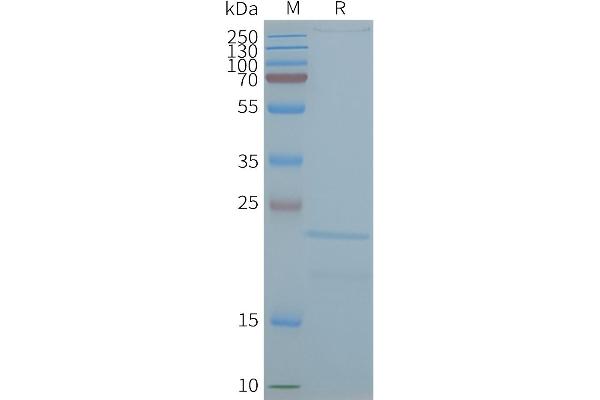 Claudin 2 Protein (CLDN2)