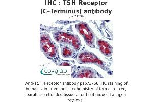 Image no. 1 for anti-Thyroid Stimulating Hormone Receptor (TSHR) (C-Term) antibody (ABIN1740418) (TSH receptor Antikörper  (C-Term))