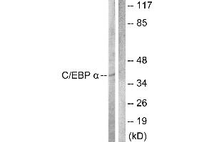 Western blot analysis of extracts from COS7 cells, treated with EGF (200ng/ml, 30mins), using C/EBP-α (Ab-222) antibody. (CEBPA Antikörper  (Thr222))