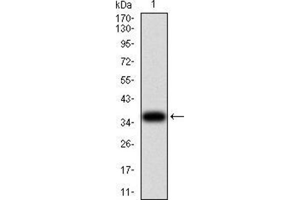 Phospholipase C gamma 1 Antikörper  (AA 1192-1291)