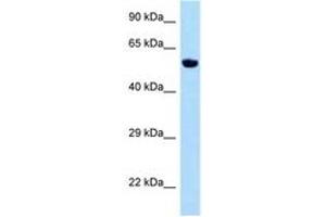 Image no. 1 for anti-Zinc Finger Protein 874b (ZFP874B) (AA 301-350) antibody (ABIN6748147) (Chitinase Antikörper  (AA 301-350))