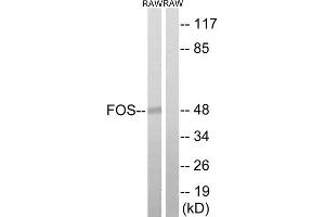 Western Blotting (WB) image for anti-c-Fos (c-Fos) (Thr232) antibody (ABIN1848286) (c-FOS Antikörper  (Thr232))