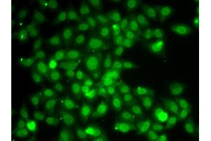 Immunofluorescence analysis of A549 cells using TRAF4 antibody. (TRAF4 Antikörper)