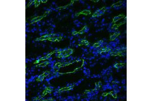 Immunofluorescence (IF) image for anti-Aquaporin 3 (Gill Blood Group) (AQP3) (C-Term) antibody (ABIN6656926)