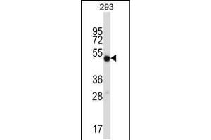 Western blot analysis in 293 cell line lysates (35ug/lane). (IMPDH1 Antikörper  (C-Term))