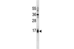 Puma antibody western blot analysis in A549 lysate. (PUMA Antikörper  (AA 109-137))