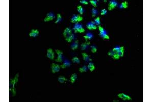 Immunofluorescence staining of Hela cells with ABIN7169031 at 1:100, counter-stained with DAPI. (PKC mu Antikörper  (AA 674-904))