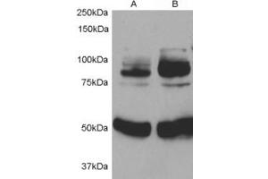 Western blot testing of rat aortic smooth muscle cells before (1) and after (2) infection with human APPL1 adenovirus for 48hrs. (APPL1 Antikörper)