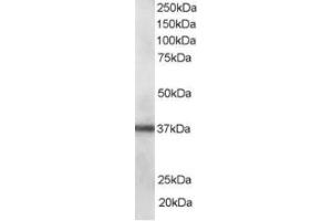 Western Blotting (WB) image for anti-PDZ and LIM Domain 1 (PDLIM1) (C-Term) antibody (ABIN2466090) (PDLIM1 Antikörper  (C-Term))