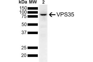 Western Blot analysis of Human SH-SY5Y lysates showing detection of 91. (VPS35 Antikörper  (PE))