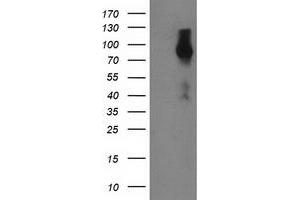 Western Blotting (WB) image for anti-Fibroblast Growth Factor Receptor 2 (FGFR2) antibody (ABIN1498252) (FGFR2 Antikörper)