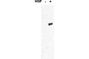 Image no. 1 for anti-Met Proto-Oncogene (MET) (pTyr1349), (pTyr1356) antibody (ABIN401382) (c-MET Antikörper  (pTyr1349, pTyr1356))