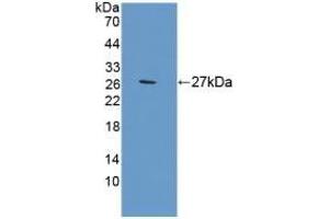 Detection of Recombinant APOA1, Rat using Polyclonal Antibody to Apolipoprotein A1 (APOA1) (APOA1 Antikörper)