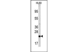 Image no. 2 for anti-BCL2-Associated Agonist of Cell Death (BAD) (Middle Region) antibody (ABIN356826) (BAD Antikörper  (Middle Region))