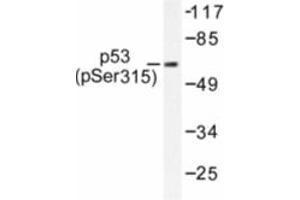 Image no. 1 for anti-Tumor Protein P53 (TP53) (pSer315) antibody (ABIN318092) (p53 Antikörper  (pSer315))