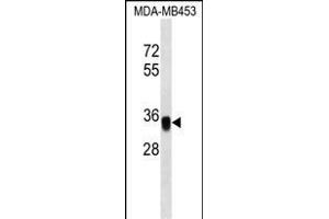 EpC Antibody (C-term) (ABIN1536832 and ABIN2849616) western blot analysis in MDA-M cell line lysates (35 μg/lane). (EpCAM Antikörper  (C-Term))