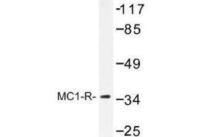 Image no. 1 for anti-Melanocortin 1 Receptor (MC1R) antibody (ABIN317707) (MC1 Receptor Antikörper)