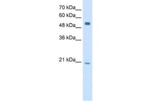 Western Blotting (WB) image for anti-B Lymphoid Tyrosine Kinase (BLK) antibody (ABIN2462928) (BLK Antikörper)