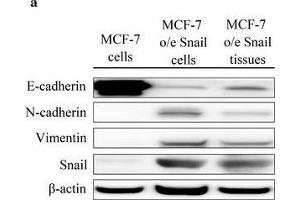 Western Blotting (WB) image for anti-Vimentin (VIM) antibody (ABIN2854814)