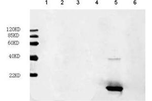 Primary antibody: 1 µg/mL FGF acidic Antibody, mAb, mouse (ABIN399028) Secondary antibody: IRDye800 Conjugated affinity purified anti-Mouse IgG [GOAT] (1: 10,000) Loading: Lane 1: hFGF-6 recombinant protein (200 ng) Lane 2: hFGF-16 recombinant protein (200 ng) Lane 3: hFGF-17 recombinant protein (200 ng) Lane 4: hFGF-18 recombinant protein (200 ng) Lane 5: FGF acidic recombinant protein (200 ng) Lane 6: FGF basic recombinant protein (200 ng) (FGF acidic Antikörper)