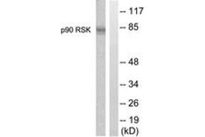 Western Blotting (WB) image for anti-Ribosomal Protein S6 Kinase, 90kDa, Polypeptide 1 (RPS6KA1) (AA 331-380) antibody (ABIN2888685) (RPS6KA1 Antikörper  (AA 331-380))