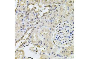 Immunohistochemistry of paraffin-embedded rat kidney using PLK4 antibody (ABIN6003595) at dilution of 1/100 (40x lens). (PLK4 Antikörper)