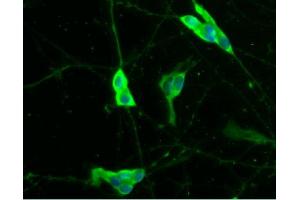 Immunofluorescent staining of differentiated SH-SY5Y cells (Human neuroblastoma, ATCC CRL-2266) (right). (S100B Antikörper  (AA 1-92))