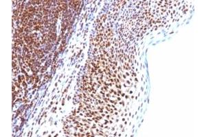 Immunohistochemistry (Formalin-fixed Paraffin-embedded Sections) (IHC (fp)) image for anti-Small Ubiquitin Related Modifier Protein 1 (SUMO1) antibody (ABIN3026864)