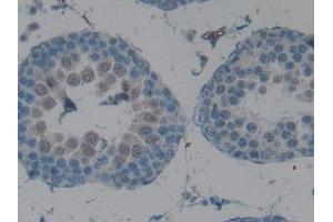 IHC-P analysis of Rat Testis Tissue, with DAB staining. (CPB2 Antikörper  (AA 164-417))