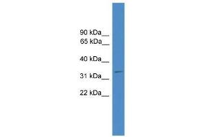 Ccnd1 antibody used at 0. (Cyclin D1 Antikörper  (C-Term))