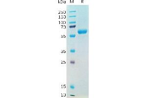 SARS-CoV-2 (2019-nCoV) S protein RBD(N501Y), hFc Tag on SDS-PAGE under reducing condition. (SARS-CoV-2 Spike Protein (B.1.1.7 - alpha, RBD) (Fc Tag))