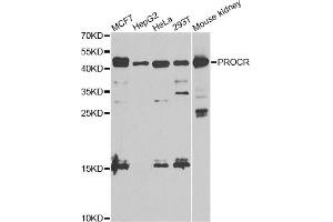 Western blot analysis of extracts of various cell lines, using PROCR antibody. (PROCR Antikörper)