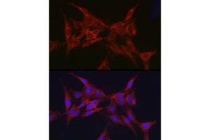 Immunofluorescence analysis of C6 cells using Parkin Rabbit pAb (ABIN6132295, ABIN6145226, ABIN6145227 and ABIN6215092) at dilution of 1:50 (40x lens). (Parkin Antikörper  (AA 1-300))