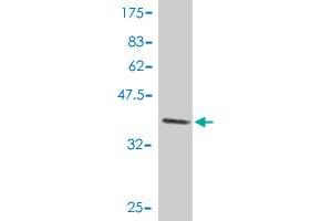 Western Blot detection against Immunogen (37. (p300 Antikörper  (AA 731-830))