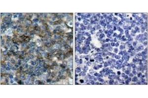 Immunohistochemistry (IHC) image for anti-Vasodilator-Stimulated phosphoprotein (VASP) (pSer157) antibody (ABIN2888553) (VASP Antikörper  (pSer157))