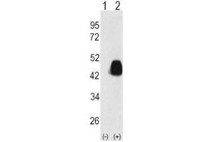 Western blot analysis of PDX1 antibody and 293 cell lysate either nontransfected (Lane 1) or transiently transfected with the PDX1 gene (2). (PDX1 Antikörper  (AA 1-30))