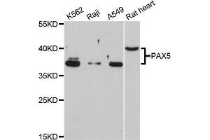 Western blot analysis of extracts of various cell lines, using PAX5 antibody (ABIN5998458) at 1/1000 dilution. (PAX5 Antikörper)