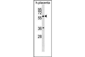 Western blot analysis of GAB3 Antibody (N-term) in human placenta tissue lysates (35ug/lane). (GAB3 Antikörper  (N-Term))