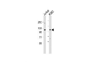 Western Blot at 1:1000 dilution Lane 1: Jurkat whole cell lysate Lane 2: K562 whole cell lysate Lysates/proteins at 20 ug per lane. (MTHFD1 Antikörper  (AA 535-562))