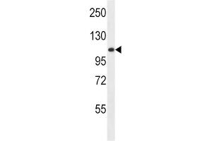 Western Blotting (WB) image for anti-Glucosidase, Alpha, Acid (GAA) antibody (ABIN2996809) (GAA Antikörper)